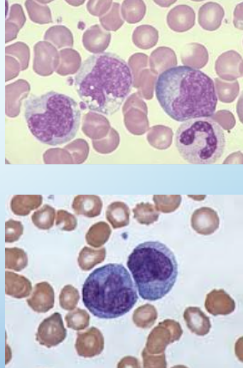 <p>monocytes</p>