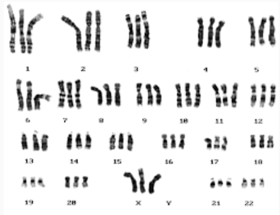 <p>Its is a chromosomal mutation where an organism has an extra set of chromosomes (3n, 4n, etc.)</p>