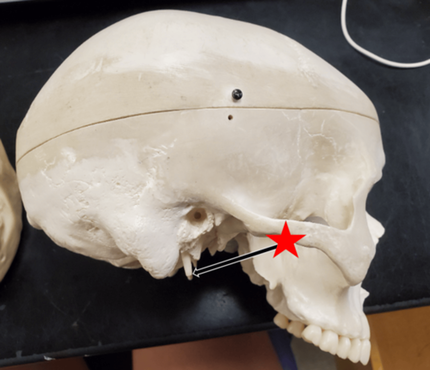<p>Name the starred region in the image.</p>