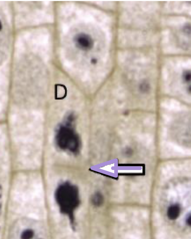 <p>what stage of cell division is this? </p>