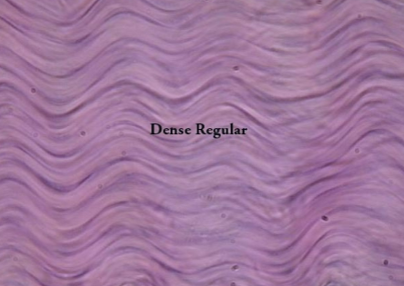 <p> Name of white fibers? Collagen fibers</p><p>Location: Tendons, ligaments, white part of the eye</p>