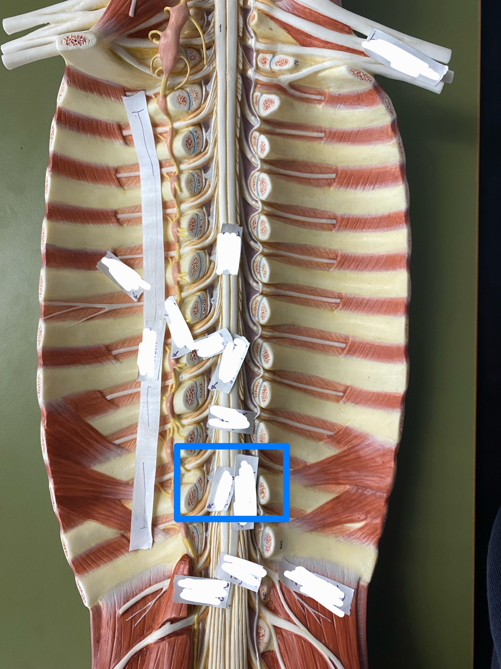 <p>ID plexus</p>
