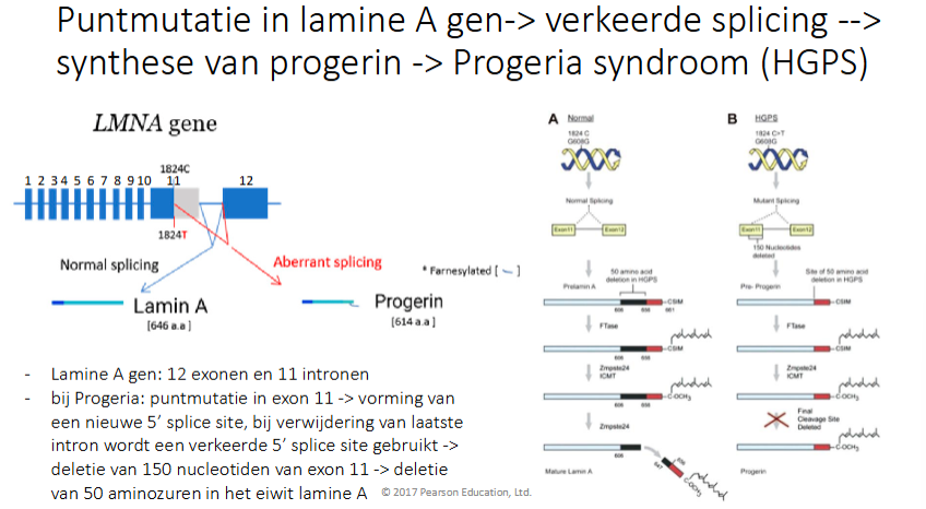 <ul><li><p>Normaal:</p></li></ul><p>lamine A eiwit gevormd → wordt gefarnesyleerd (signaal om naar nucleaire membraan te gaan) → wordt dan afgeknipt</p><p></p><ul><li><p>Bij progeria:</p></li></ul><p>Puntmutatie in lamine A gen → 50 AZ’en verwijderd</p><p>De ferneslyering treedt nog op → knippen gebeurt niet meer omdat de knippplats voor het protease in de 50 AZ’en aanwezig waren. D>oordat het niet geknipt wordt, blijft het aanwezig in de nucleaire membraan en krijg je daar geen mooie vezels.</p><p>Het lamine A gen heeft 12 exonen en 11 intronen</p><p>Door de puntmutatie in exon 11 wordt er een alternatieve 5’ splice site gegenereerd waardoor 150nt (zijn dus 50 AZ’en) worden verwijderd</p>