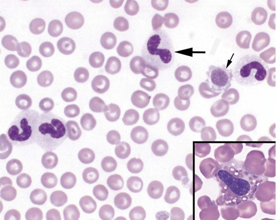<p>The leukocytes found on this image are</p>
