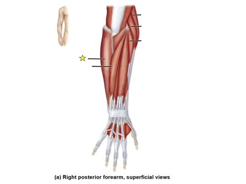 <p>identify the muscle</p>