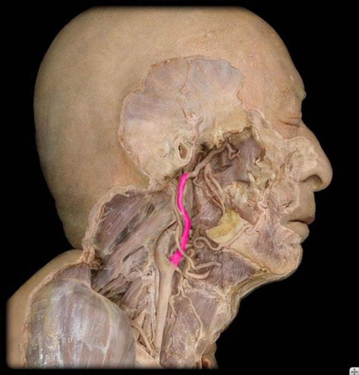 <p>Name this specific vessel.</p>