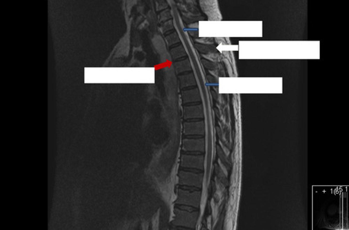 <p>what is this image?</p><p>what are the arrows indicating?</p>