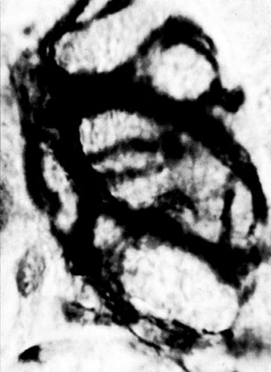 <p>?</p>
