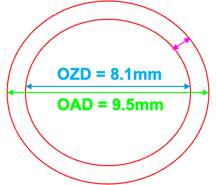 <p>The <mark data-color="#f7f068" style="background-color: rgb(247, 240, 104); color: inherit;">OAD should be 1.4 mm larger than the OZD t</mark>o give room for application of peripheral curves (0.7 mm on each side)</p>