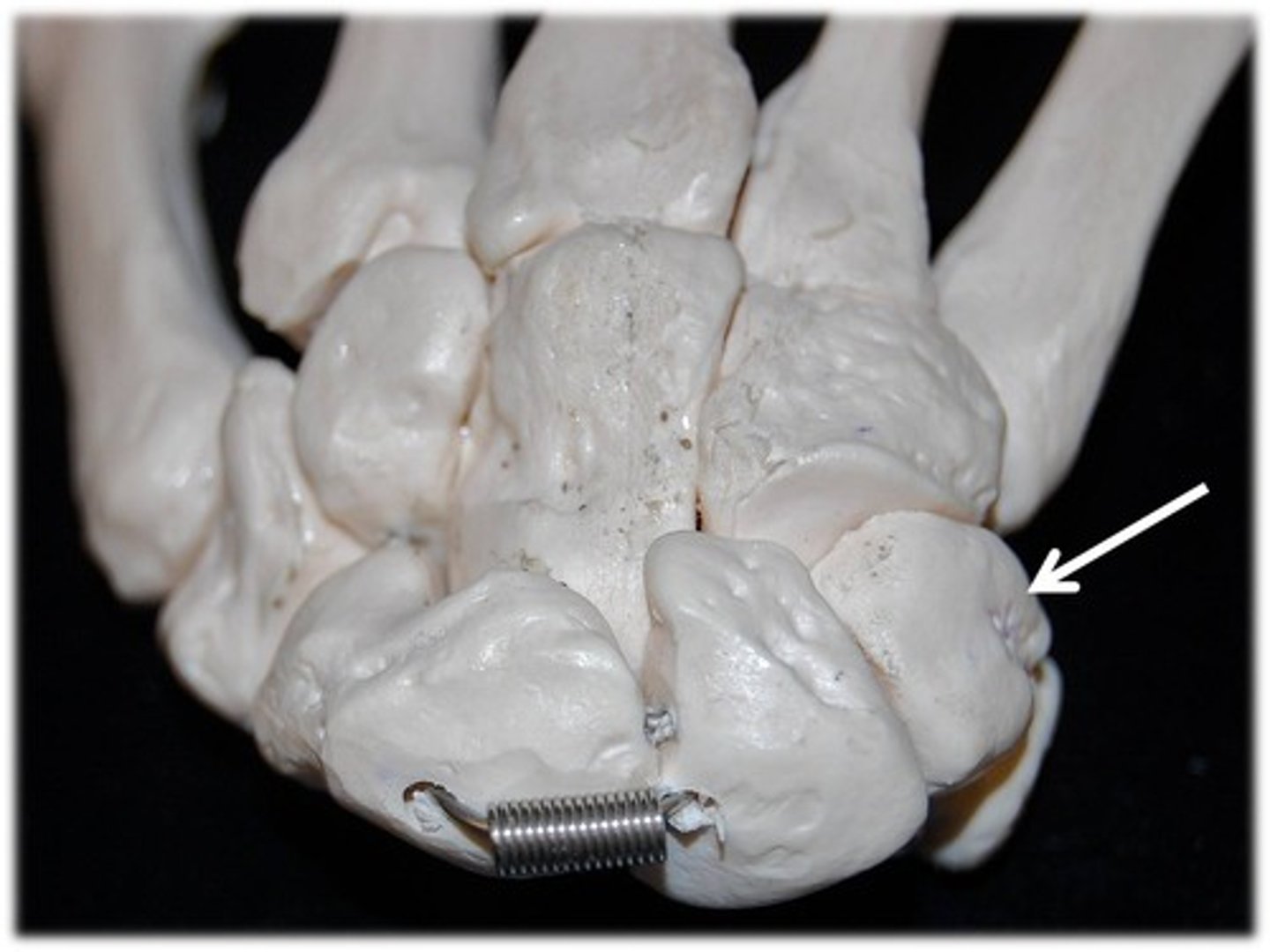 <p>Name this specific bone of the hand (posterior view).</p>