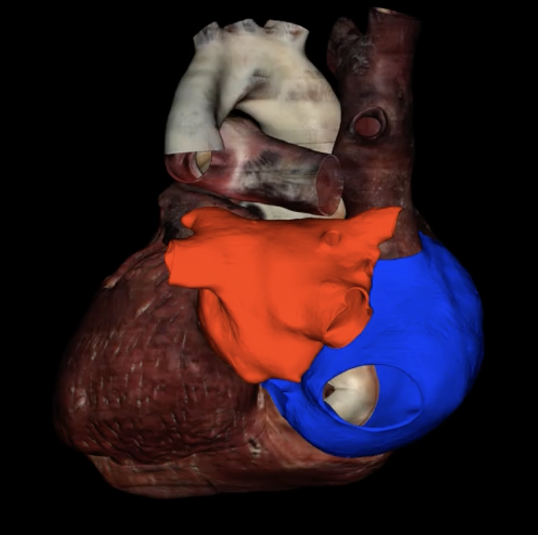 <p>What is highlighted in red?</p>