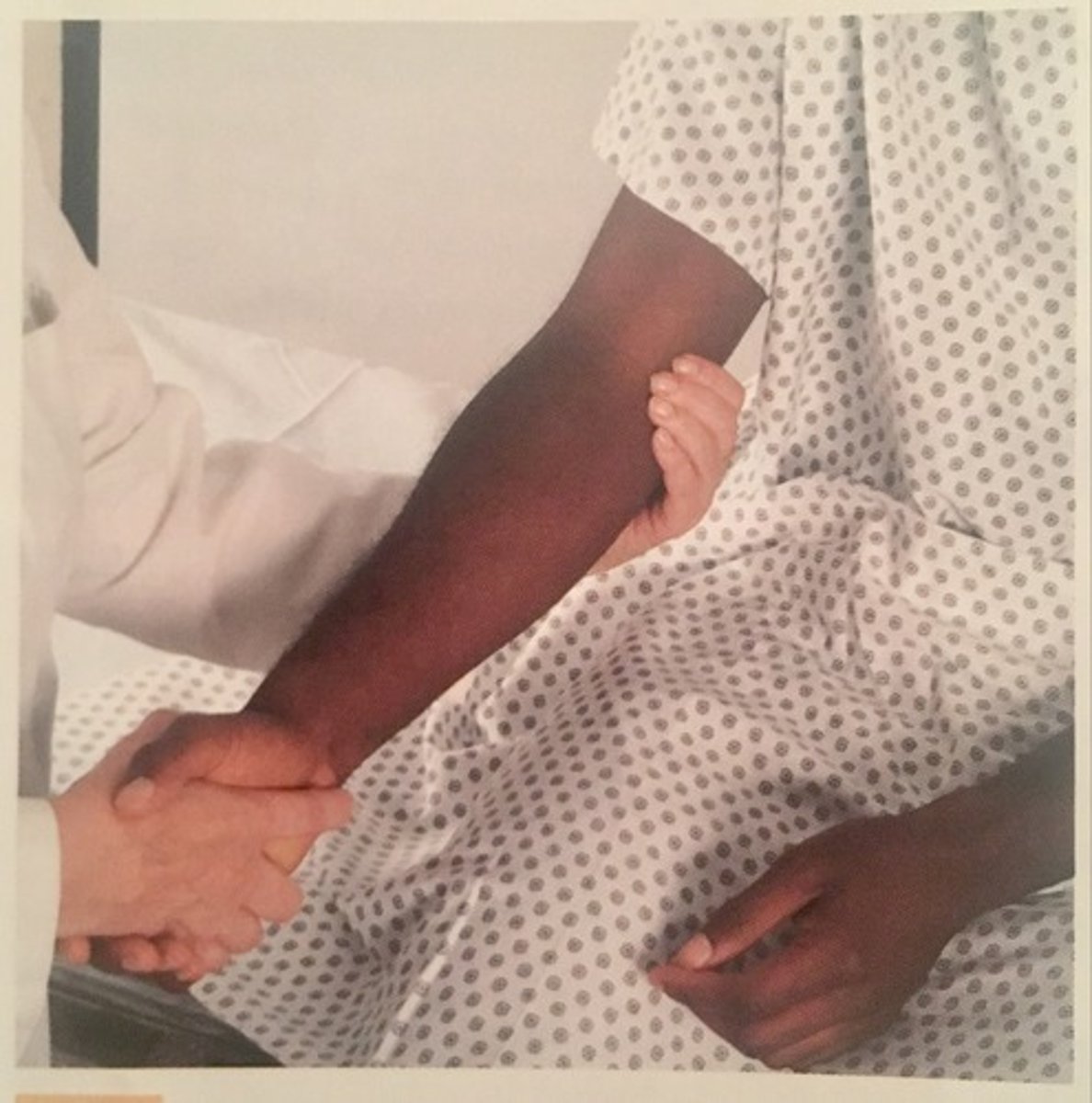<p>The lymph node in the depression above and behind the medial condyle of humerus; normally not palpable</p>