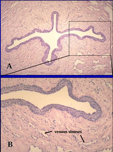 <p>Corpus spongiosum, canine penis. </p><p>The penile urethra and its erectile body, the corpus spongiosum penis, are seen in Figures A and B. </p><p>The <strong>urethra is lined by a stratified cuboidal epithelium</strong>. </p><p>Erectile tissue (represented by the venous sinuses) is present in the lamina propria.</p>