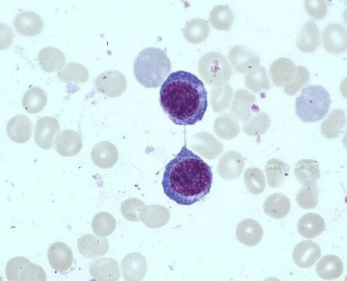 <ul><li><p>16-18 u</p></li><li><p>lower n:c ratio</p></li><li><p>coarser chromatin</p></li><li><p>nucleoli</p></li><li><p>basophilic cytoplasm </p></li><li><p>no granules</p></li></ul><p></p>