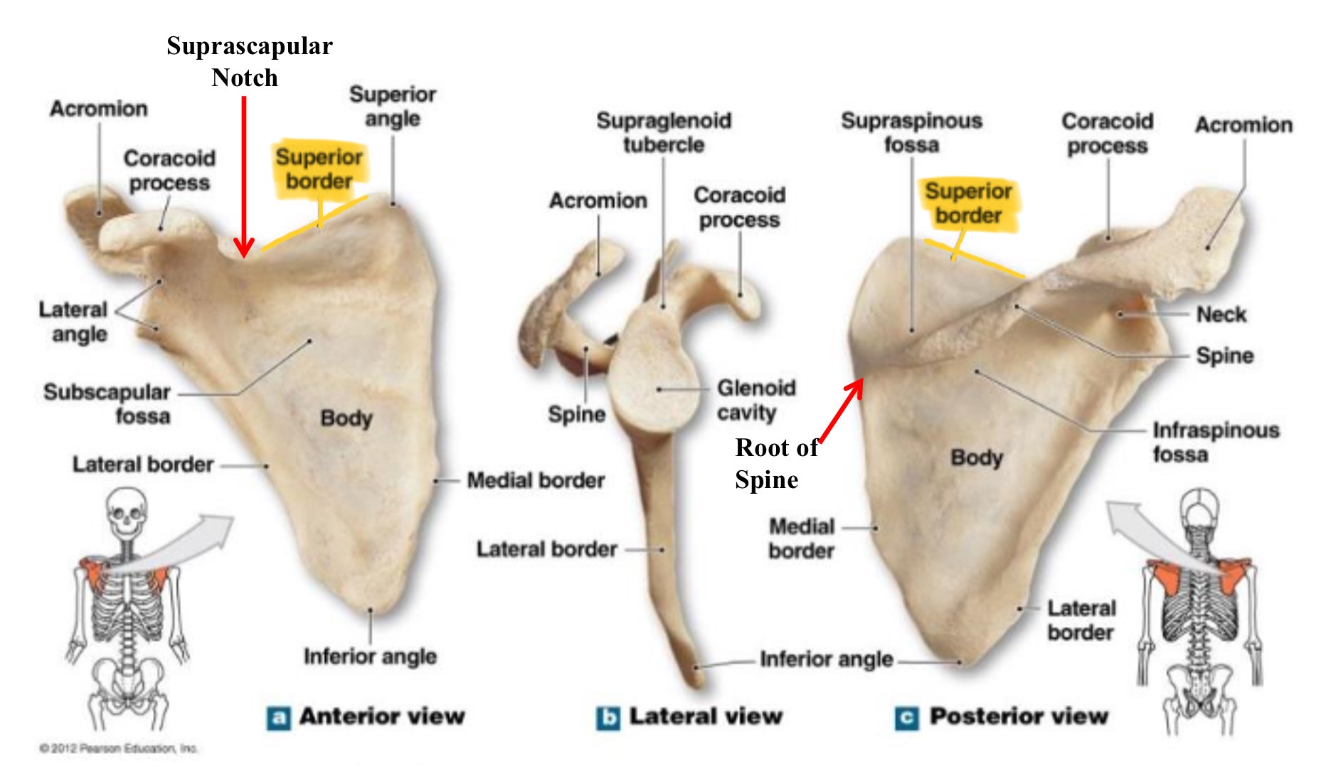 <p>superior border of scapula</p>