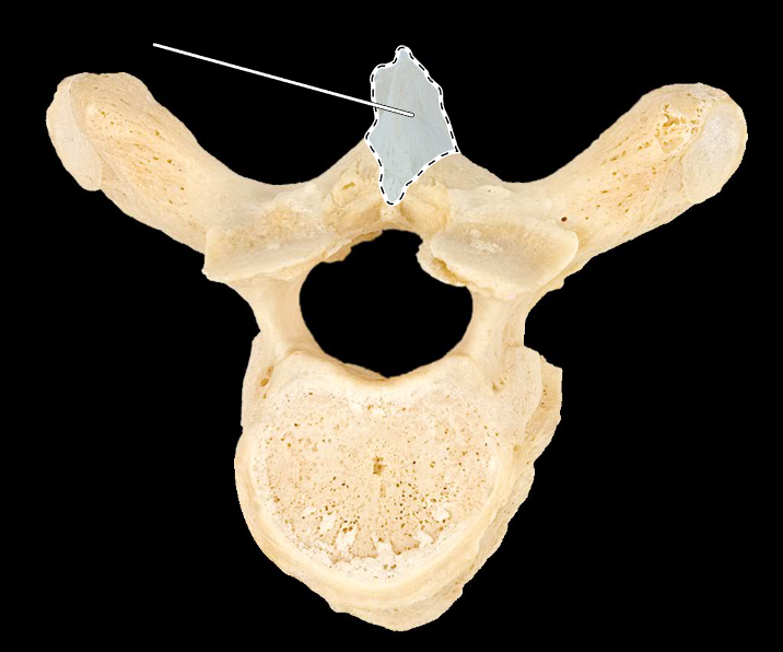 <p>What part of the vertebra is highlighted?</p><p>What type of vertebra is this (which region is this vertebra from)?</p><p>(Superior view).</p>