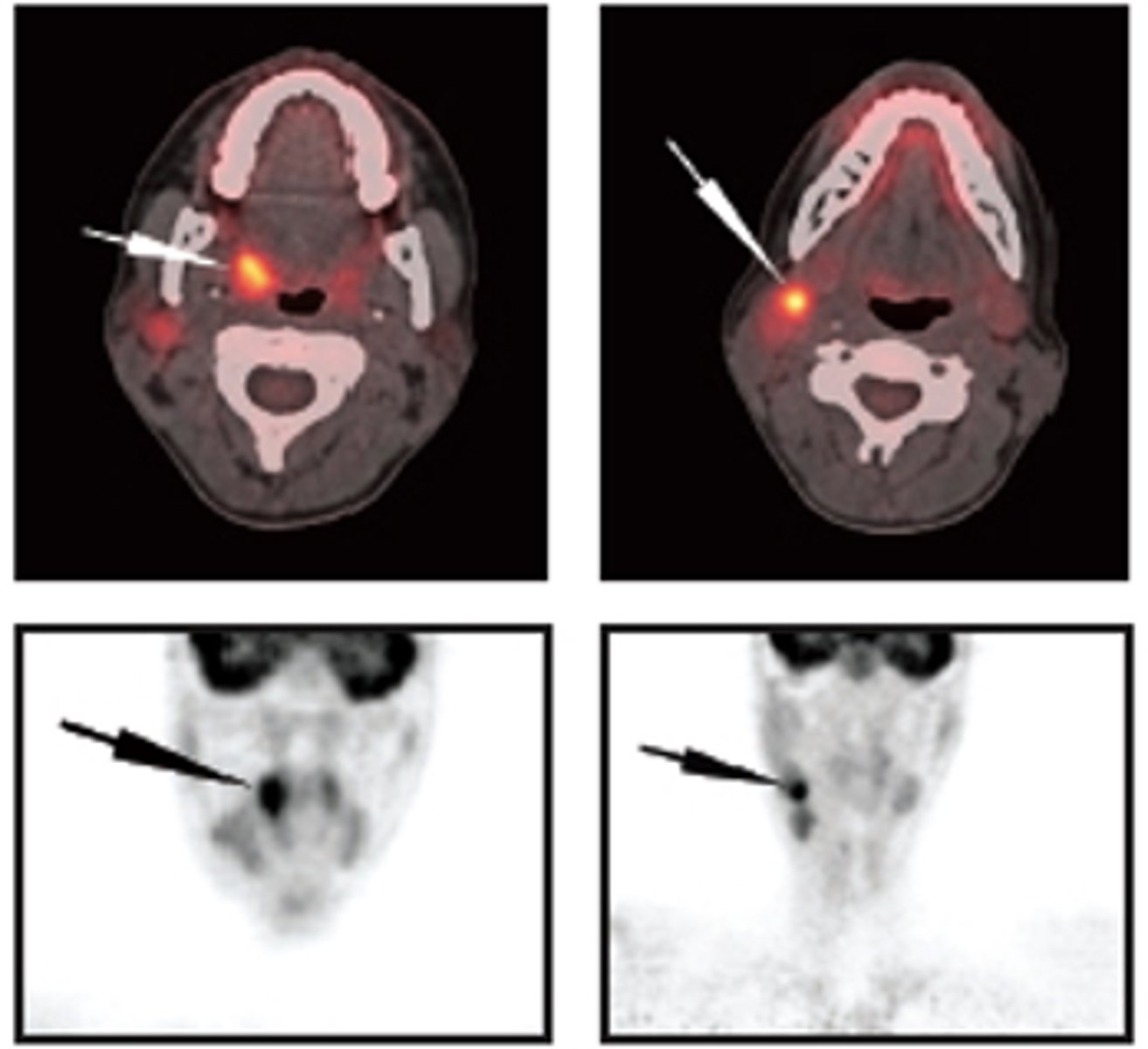 <p>ID the type of Imaging modality:</p><p>- Pano</p><p>- CT</p><p>- CBCT</p><p>- MRI</p><p>- Technetium 99 bone scans</p><p>- PET</p>