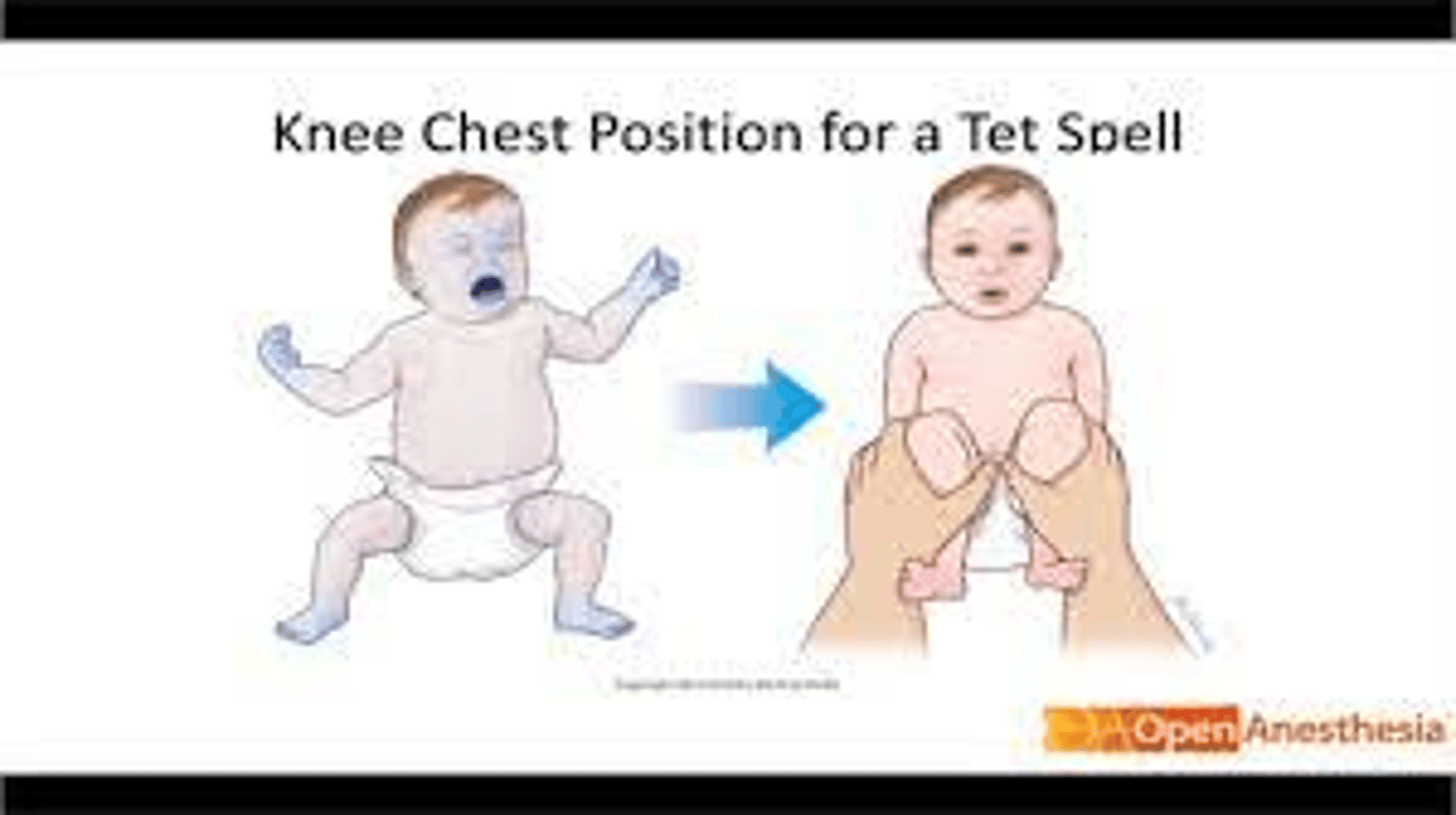 <p>Knee to chest position, ER if prolonged, tell Dr ASAP</p>