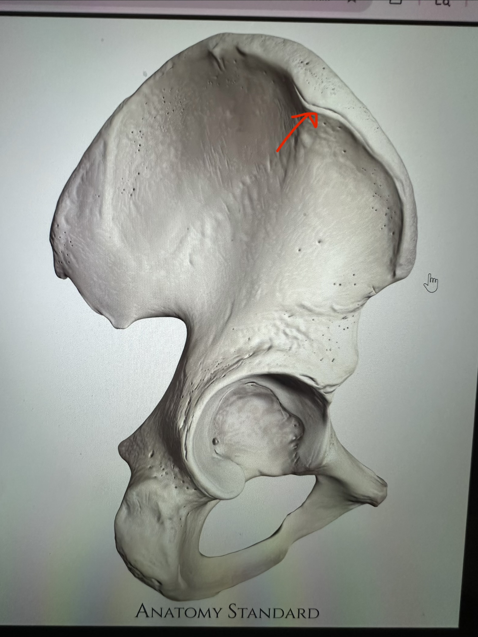 <p>os coxae, thickening at superior terminus of iliac pillar</p>