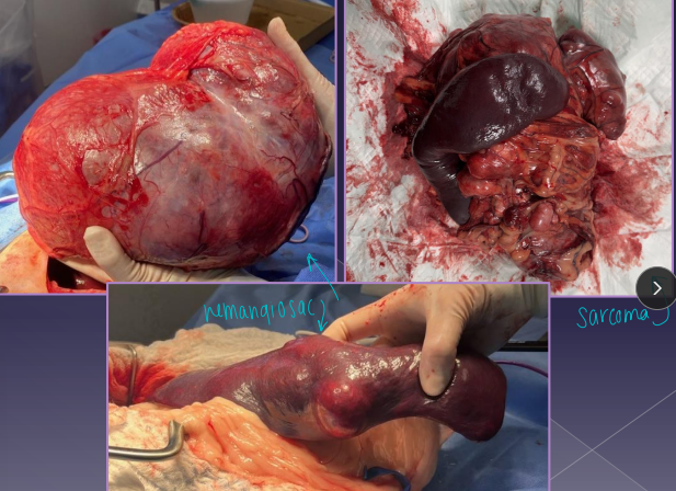 <ul><li><p><span style="color: rgb(136, 136, 136);"><strong>Et: VERY common!</strong></span></p><ul><li><p><strong>Non-neoplastic:</strong> <span style="color: red;">hematoma</span>, lipoma, myelolipoma</p></li><li><p><strong>Benign:</strong><span style="color: red;"> hemangioma</span>, fibroma</p></li><li><p><strong>Malignant:</strong> <span style="color: red;">hemangiosarcoma HSA (#1</span>), fibrosarcoma, liposarcoma, MCT</p></li></ul></li><li><p><span style="color: rgb(136, 136, 136);"><strong>Sig:</strong></span><strong> Lg-breed dogs</strong></p></li><li><p><span style="color: rgb(136, 136, 136);"><strong>Cs:</strong></span> shock, mass, enlarged abdomen, fluid wave, lethargy, pain, vomiting, <span style="color: red;">PCV on free fluid - determine blood, VPCs</span></p></li><li><p><span style="color: rgb(136, 136, 136);"><strong>Dt:</strong></span><strong> </strong>Abd rads (mass effect, effusion, metastasis), US (mixed echotexture, cavitated lesions, enlarged spleen), biopsy</p><ul><li><p><span style="color: red;"><strong><u>Xray chest for mets!</u></strong></span></p></li></ul></li><li><p><span style="color: rgb(136, 136, 136);"><strong>Tx:</strong> </span>splenectomy</p></li></ul><img src="https://knowt-user-attachments.s3.amazonaws.com/a23ef6a5-b3a6-4fc6-b9a8-822169dfaf30.png" data-width="50%" data-align="center" alt="Mets - lungs"><img src="https://knowt-user-attachments.s3.amazonaws.com/7f5fdb5f-d03e-4827-b96c-00dcce40c043.png" data-width="50%" data-align="center" alt="VPCs"><p></p>