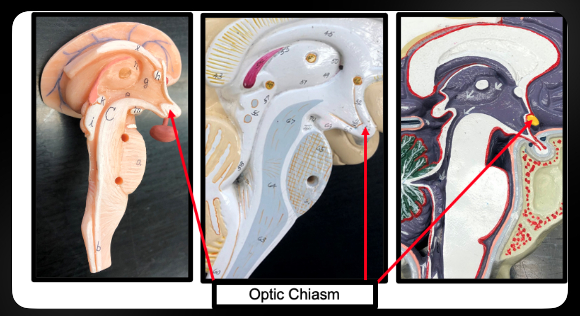 <p>Optic Chiasm</p>