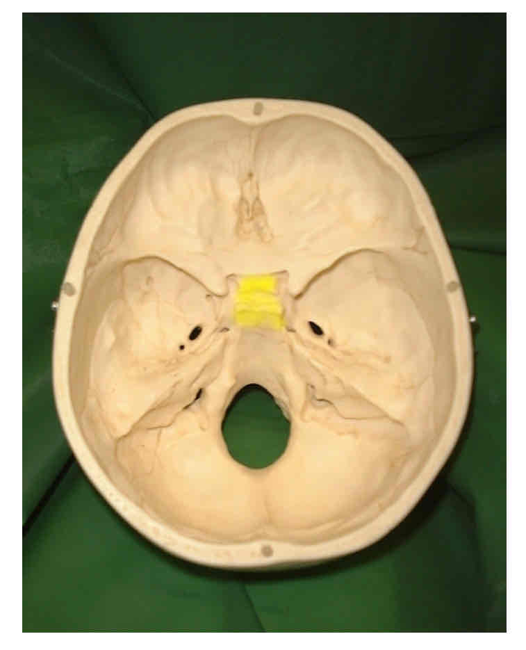 term image