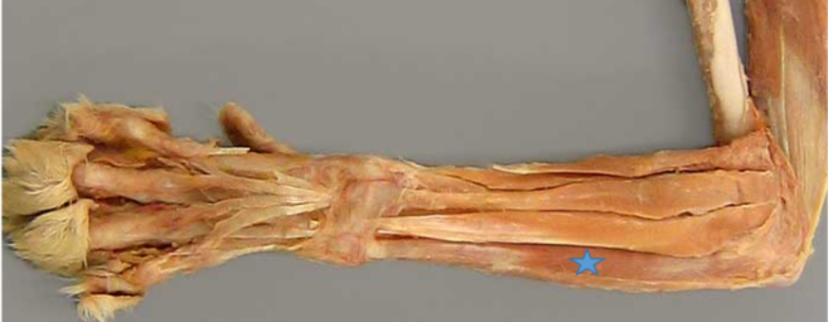 <p>Extensor carpi ulnaris m. (blue star)</p>