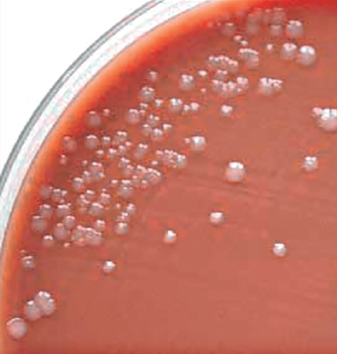 <p>Milieu : Gélose au sang cuit </p><p>Incubation : 48 à 72h à 35 degrés sous 10% de CO2</p><p>Colonies : Grisâtres</p><p>Caractéristiques : Glucose +, Maltose -</p>