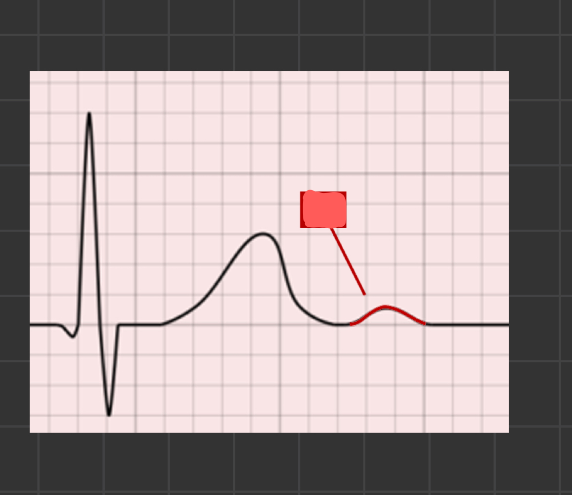 <p>What is the arrow pointing to</p>