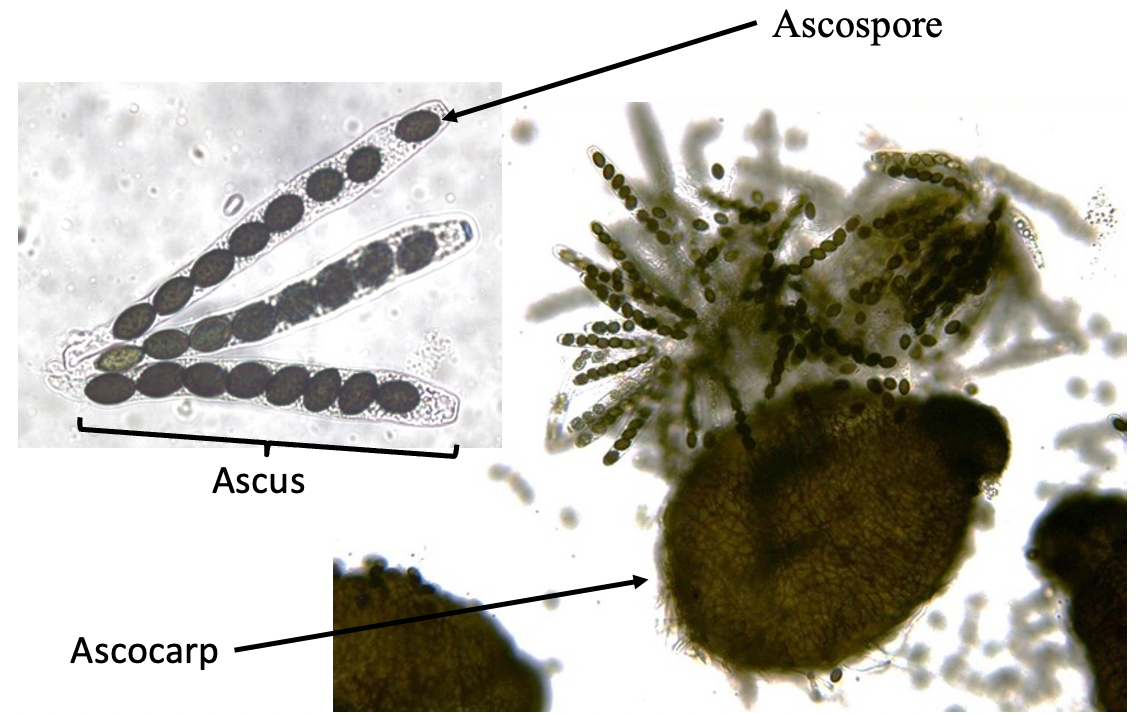 <p>Contain asci (sacs) which contain ascospores</p>