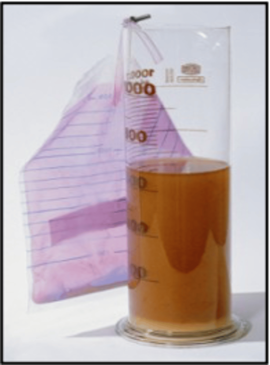 <p>what c/s is shown to indicate UTIs</p>