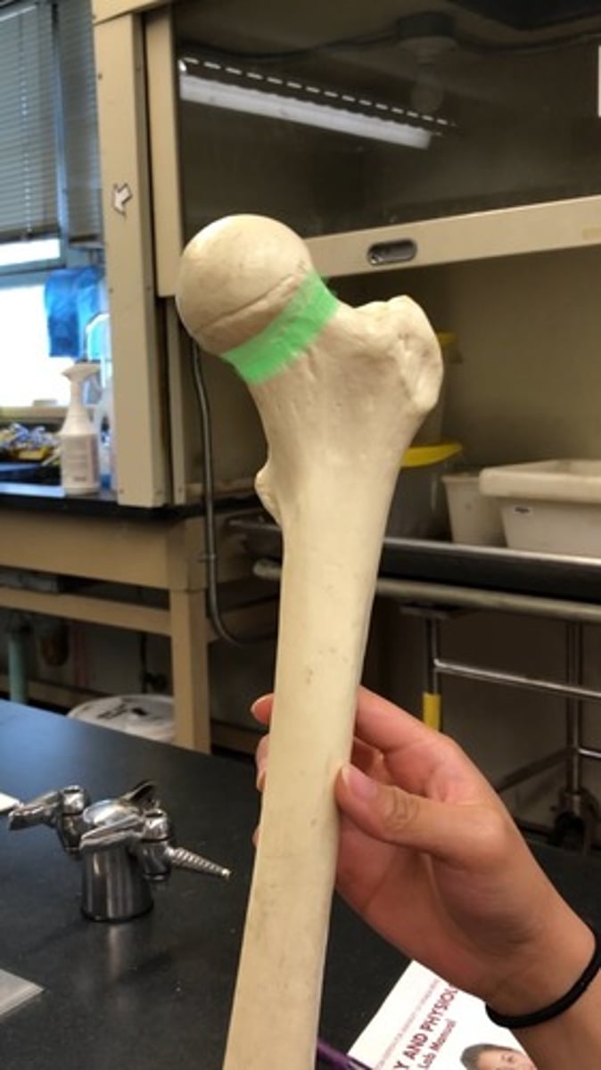<p>narrows after femoral head</p>