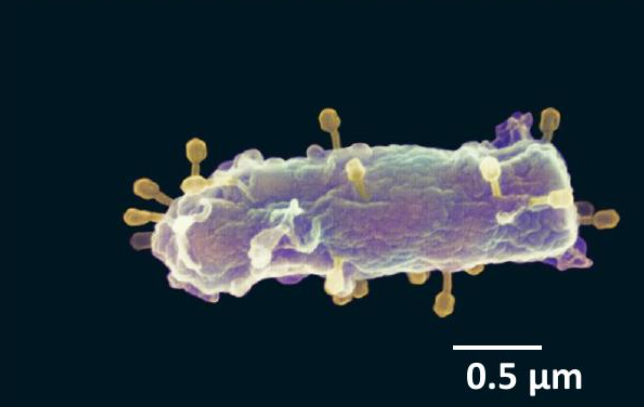 <p>Viruses that infect bacteria.</p>