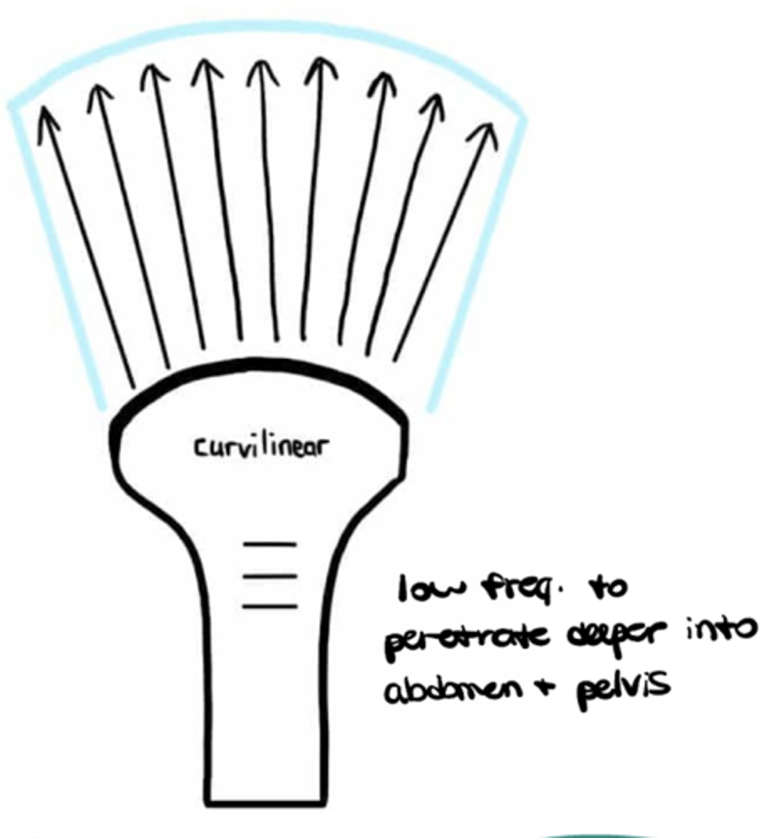 <p>Curvilinear with LOW frequency (narrow at the top and wider at the bottom)</p>
