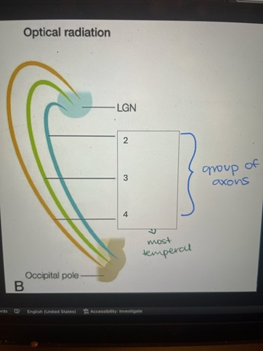 <p>Label the components of optical radiation (#2-4)</p>