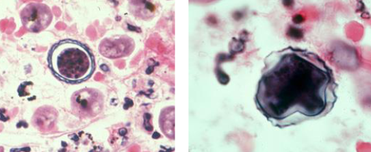 <p>What is this?</p><ul><li><p>can be found in brain, skin, eyes, lungs</p></li></ul><p></p>