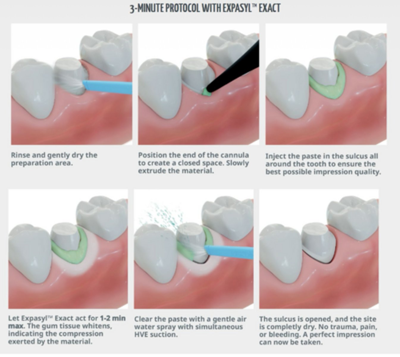 <p>What technique is shown?</p>