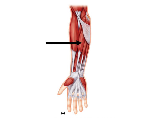 wrist flexion PM, abduction