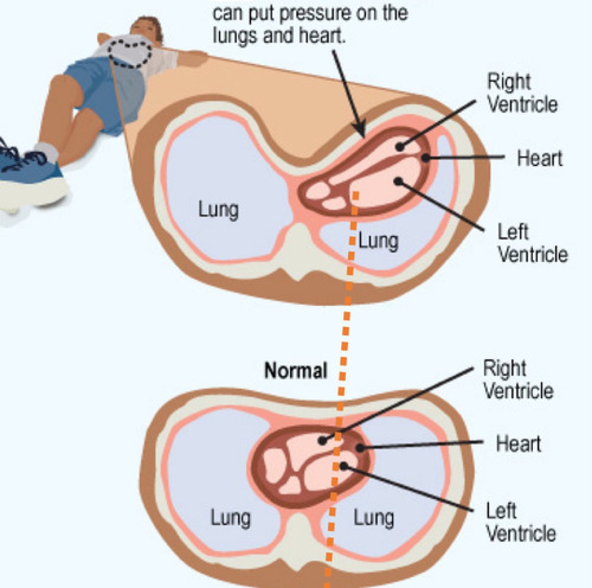 <p>What is demonstrated by this image</p>