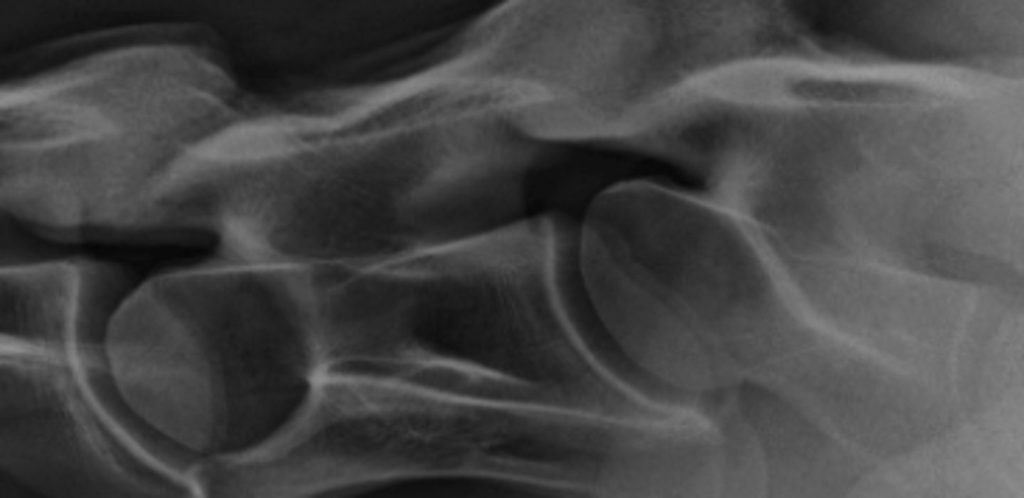 <p>What is wrong with this spine?</p>