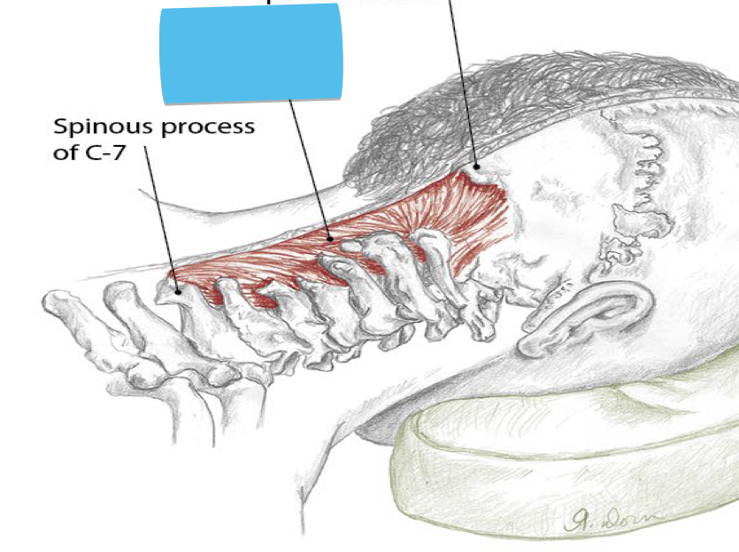 <p>Identify this structure and anatomical significance</p>