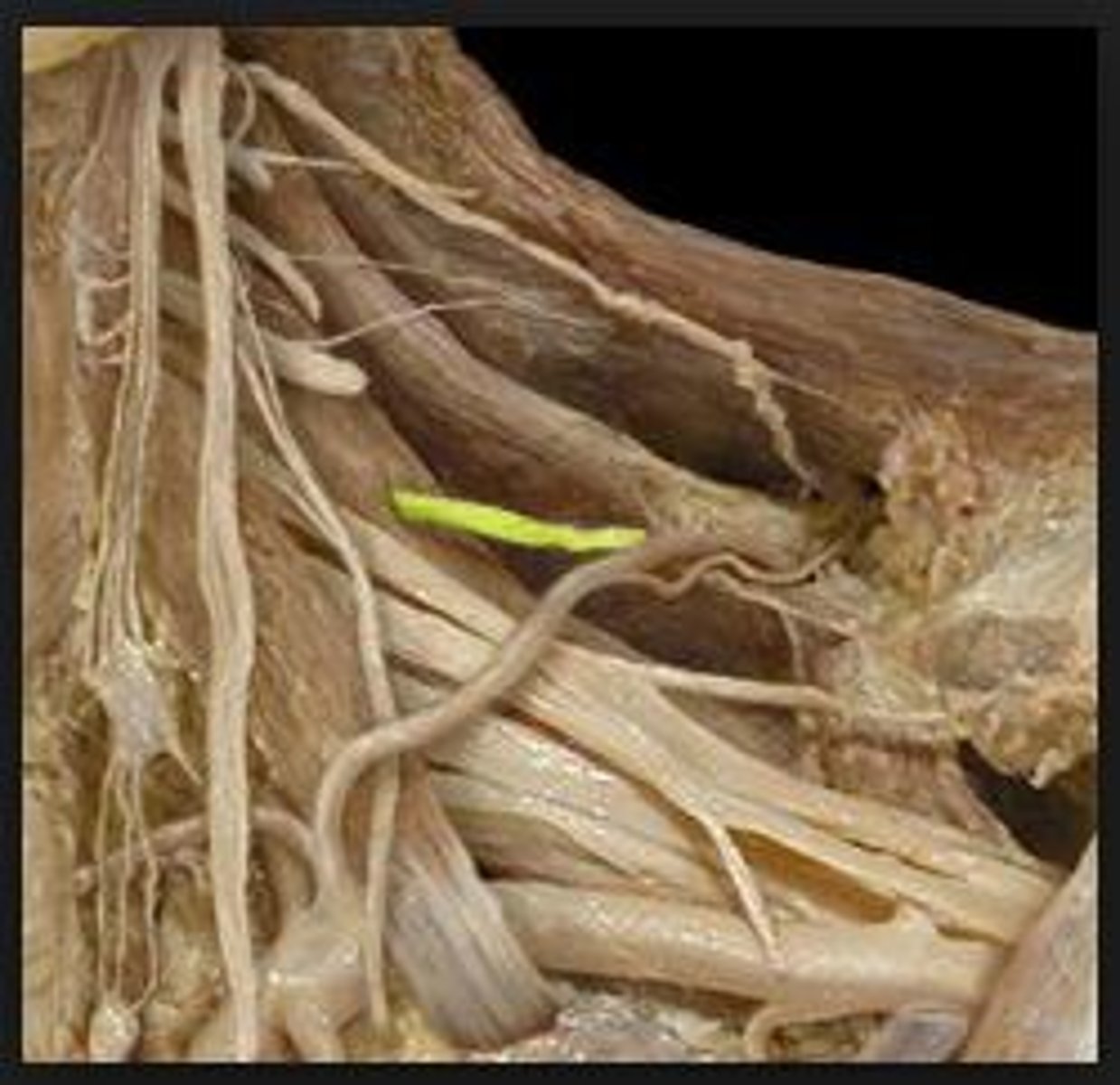 <p>rhomboid major &amp; minor, levator scapulae innervating nerve</p>