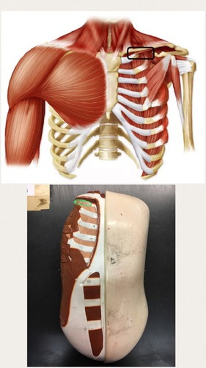 <p>Tiny muscle under clavicle</p>