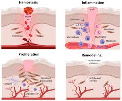 <p>wound healing</p>