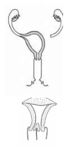 <p>Females: </p><ul><li><p>uterus unicornis </p><ul><li><p>one horn instead of two </p></li><li><p>can lead to dystocia </p></li></ul></li><li><p>double cervices - fail to conceive, lead to dystocia </p></li><li><p>segmental aplasia of vagina/uterus - lead to dystocia </p></li></ul><p>Males: </p><ul><li><p>all may interfere with breeding </p></li><li><p>hypospadia - urethra opening is somewhere other than the tip of the penis </p></li><li><p>persistent frenulum </p></li><li><p>retained testicles </p></li></ul><p></p>