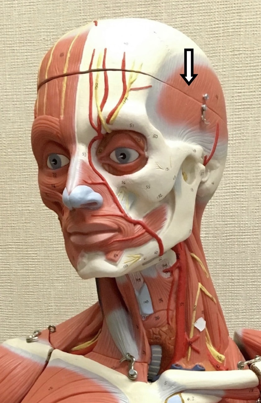 <p><span>Name the muscle labeled with the white arrow below AND name the insertion .</span></p>