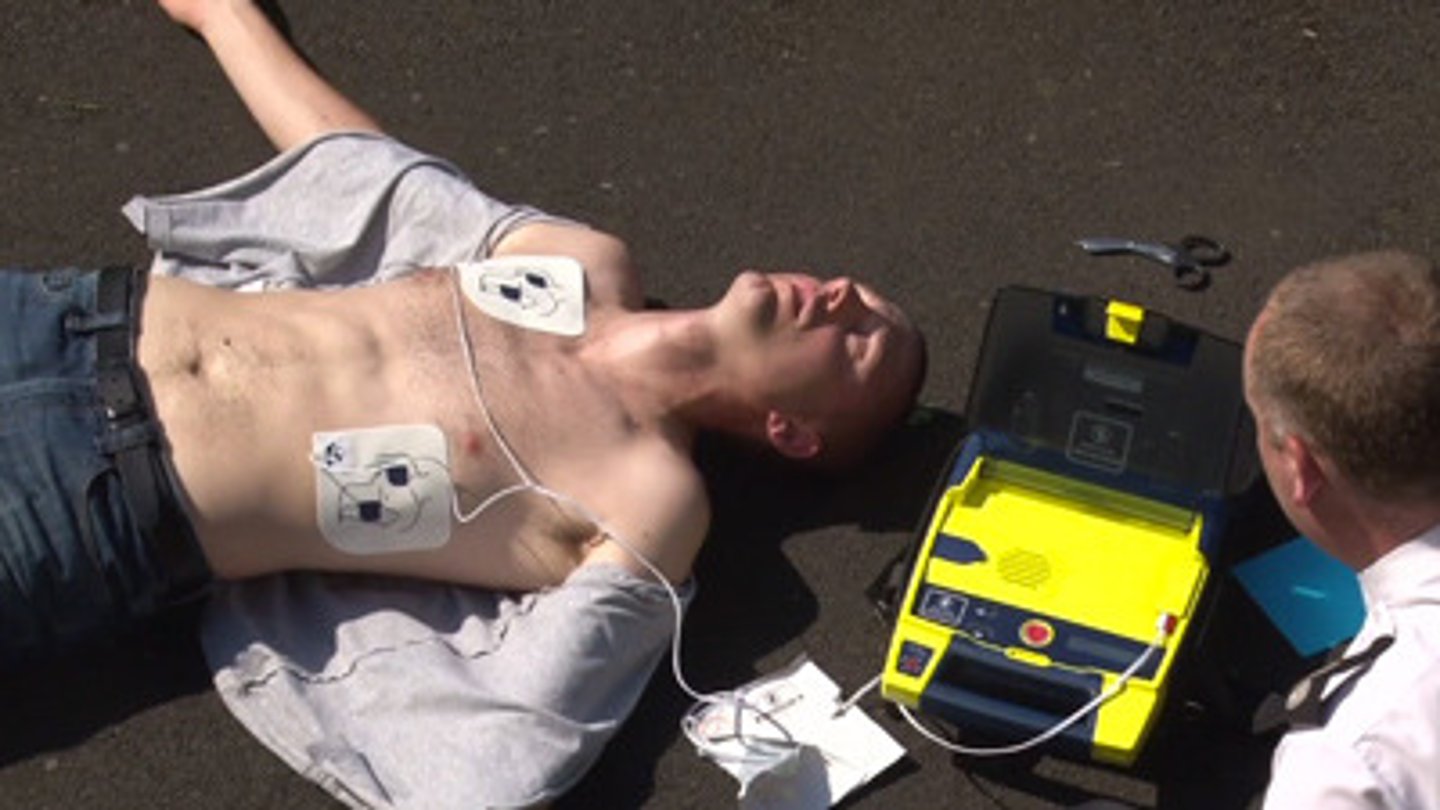 <p>- early activation of EMS</p><p>- early CPR</p><p>- rapid defribrillation</p><p>Turn on AED, PADS, Clear, Charge, Shock</p><p>- advanced life support</p><p>- post-cardiac arrest care</p>