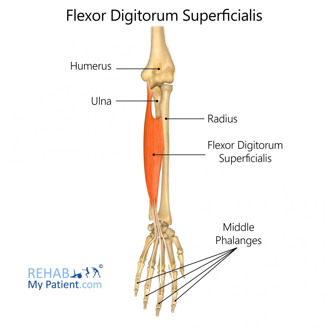 <p>origin: humerus</p><p>insertion: middle phalanges of II-V</p><p>action: flexes hand and middle phalanges of II-V</p><p></p>