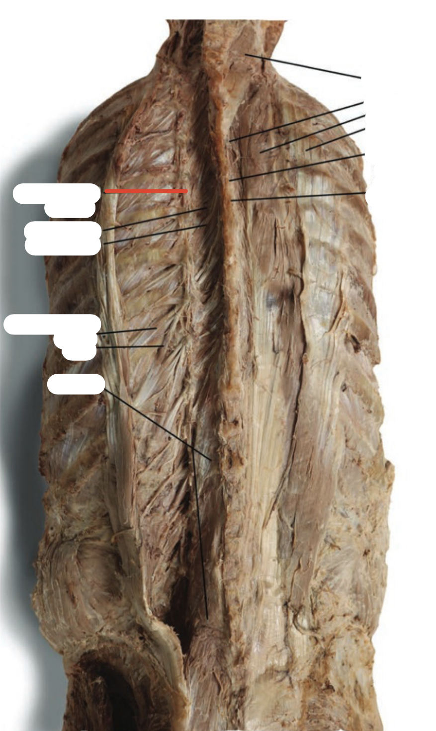 Identify the structure (red line)