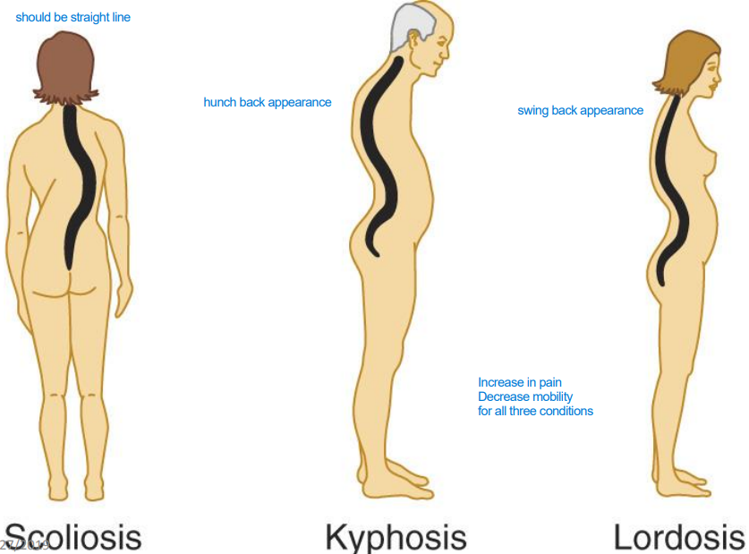 <p>Normal vertebral curvatures help distribute body weight and maintain balance. Abnormal curvatures, such as scoliosis (lateral curve), <mark data-color="yellow" style="background-color: yellow; color: inherit">kyphosis (hunchback), and lordosis (swayback)</mark>, can lead to pain, decreased mobility, and may require medical intervention</p>